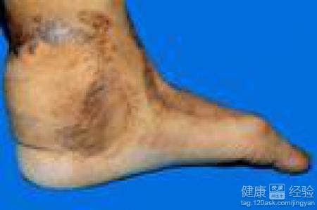 肿胀菌视频,揭示其神秘生物特性与生态作用