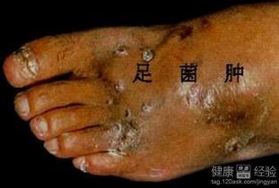 肿胀菌视频,揭示其神秘生物特性与生态作用